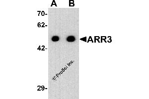 Western Blotting (WB) image for anti-Arrestin 3, Retinal (X-Arrestin) (ARR3) (C-Term) antibody (ABIN2457884) (ARR3 Antikörper  (C-Term))