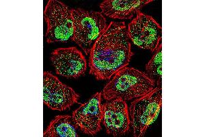 Fluorescent confocal image of U251 cell stained with KLF5 Antibody . (KLF5 Antikörper  (C-Term))