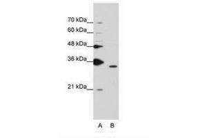 Image no. 2 for anti-Peptidylprolyl Isomerase E (Cyclophilin E) (PPIE) (AA 103-152) antibody (ABIN203046)