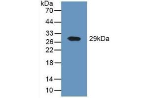 Detection of Recombinant DPP4, Human using Polyclonal Antibody to Cluster Of Differentiation 26 (CD26)