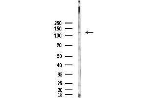 Western blot analysis of lysates from Hela cells(LPS, 4h treatment), using BUB Antibody at 1/1000 dilution.