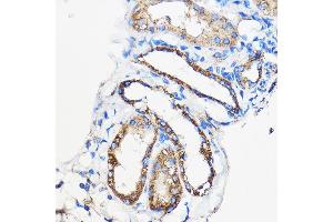 Immunohistochemistry of paraffin-embedded Mouse kidney using /// Rabbit pAb (ABIN7265627) at dilution of 1:50 (40x lens). (ANT1+ANT2+ANT3+ANT4 (C-Term) Antikörper)