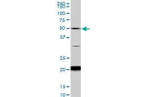 NADK monoclonal antibody (M01), clone 5F4. (NADK Antikörper  (AA 1-446))