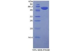 SDS-PAGE (SDS) image for Protein S (PROS) (AA 261-496) protein (His tag,GST tag) (ABIN1879906)
