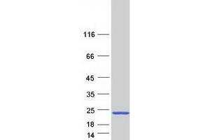 Western Blotting (WB) image for LIM Domain Only 2 (Rhombotin-Like 1) (LMO2) (Transcript Variant 3) protein (Myc-DYKDDDDK Tag) (ABIN2730874)