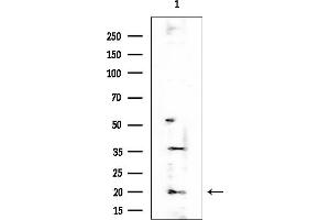 Western blot analysis of lysates from Mouse testis, using CIRBP Antibody at 1/1000 dilution.