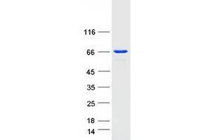 UTP6 Protein (Myc-DYKDDDDK Tag)