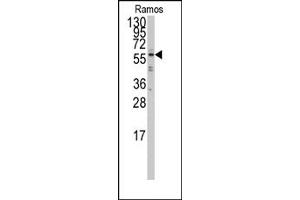 Image no. 1 for anti-Interferon Regulatory Factor 5 (IRF5) (N-Term) antibody (ABIN357996) (IRF5 Antikörper  (N-Term))