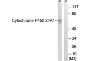 Western blot analysis of extracts from JurKat cells, using Cytochrome P450 24A1 Antibody. (CYP24A1 Antikörper  (AA 411-460))