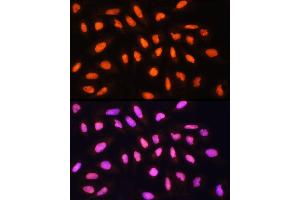 Immunofluorescence analysis of U-2 OS cells using KA Rabbit pAb (ABIN1679964, ABIN5664011, ABIN5664013 and ABIN6219456) at dilution of 1:100 (40x lens). (KAT2A Antikörper  (AA 1-100))