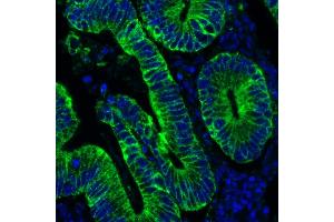 anti-Keratin 1 (KRT1) antibody