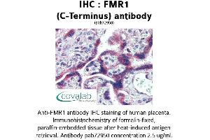 Image no. 1 for anti-Fragile X Mental Retardation 1 (FMR1) (C-Term), (Internal Region) antibody (ABIN1734384) (FMR1 Antikörper  (C-Term, Internal Region))