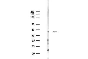 Western blot analysis of lysates from HepG2 cells(LPS,4h treatment), using LARP6 Antibody at 1/1000 dilution.