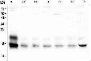 Western blot analysis of Cystatin C using anti-Cystatin C antibody (ABIN5692830).