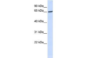 WB Suggested Anti-GPR177 Antibody Titration:  0. (GPR177/WLS Antikörper  (Middle Region))
