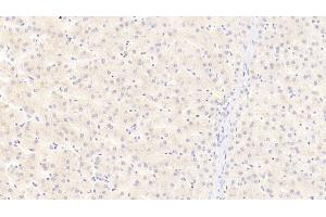 Detection of APOC3 in Human Liver Tissue using Polyclonal Antibody to Apolipoprotein C3 (APOC3) (APOC3 Antikörper  (AA 21-99))