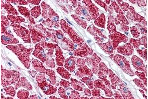 Human Heart (formalin-fixed, paraffin-embedded) stained with VDAC2 antibody ABIN337065 at 2. (VDAC2 Antikörper  (AA 298-309))