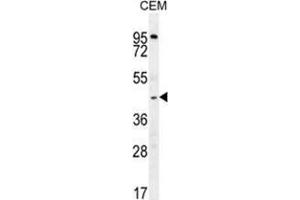 ZMYND10 Antibody (Center) western blot analysis in CEM cell line lysates (35 µg/lane). (ZMYND10 Antikörper  (Middle Region))