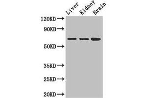 Western Blot Positive WB detected in: Mouse liver tissue, Mouse kidney tissue, Mouse brain tissue All lanes: AK5 antibody at 2. (Adenylate Kinase 5 Antikörper  (AA 61-215))