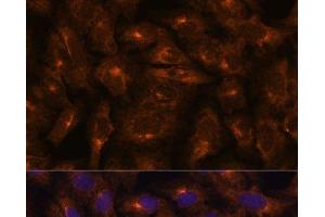 Immunofluorescence analysis of U-2 OS cells using IFITM3 Polyclonal Antibody at dilution of 1:100. (IFITM3 Antikörper)