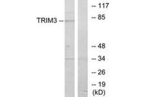 Western blot analysis of extracts from COLO cells, using TRIM3 Antibody. (TRIM3 Antikörper  (AA 1-50))
