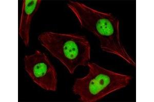 Fluorescent image of U251 cells stained with SUMO2/3 antibody. (SUMO2/3 Antikörper  (AA 49-81))