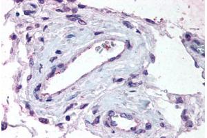 Human Testis, Vessels (formalin-fixed, paraffin-embedded) stained with ADAMTS1 antibody ABIN625844 at 1. (ADAMTS1 Antikörper  (Internal Region))