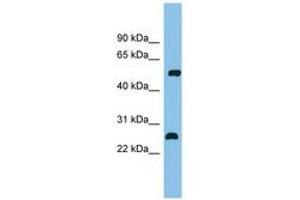 Image no. 1 for anti-Myocyte Enhancer Factor 2D (MEF2D) (C-Term) antibody (ABIN6744683) (MEF2D Antikörper  (C-Term))