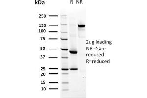 SDS-PAGE Analysis Purified MSH6 Mouse Monoclonal Antibody (MSH6/2927).