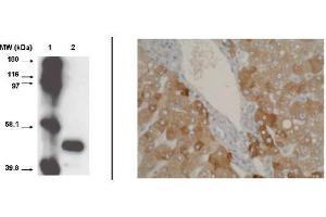 Immunohistochemistry (IHC) image for anti-Cytochrome P450, Family 2, Subfamily A, Polypeptide 6 (CYP2A6) (C-Term), (pSer472) antibody (ABIN264498)