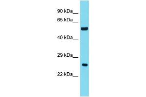 Host: Rabbit Target Name: ANKRD18A Sample Type: Fetal Liver lysates Antibody Dilution: 1. (ANKRD18A Antikörper  (C-Term))