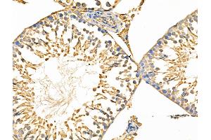 ABIN6258818 and ABIN6274459 at 1/100 staining Rat testis tissue by IHC-P. (KAT2A Antikörper  (C-Term))