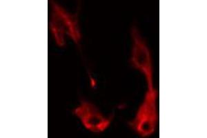 ABIN6274345 staining HeLa cells by IF/ICC. (ITPK1 Antikörper  (Internal Region))