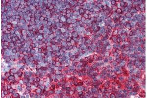 Human Thymus (formalin-fixed, paraffin-embedded) stained with TUBB antibody ABIN305890 at 1:100 followed by biotinylated goat anti-rabbit IgG secondary antibody ABIN481713, alkaline phosphatase-streptavidin and chromogen.