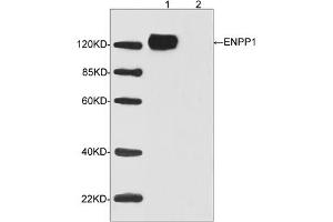 Western blot analysis of transfected HEK293 cell lysates using ENPP1 Antibody (ABIN398962, 1 µg/mL) Loading: Lane 1: Human ENPP1 expression in transfected HEK293 cell lysateLane 2: Non-transfected HEK293 cell lysateSecondary antibody: Donkey Anti-Goat IgG (H&L) [HRP] (ABIN398411, 1: 5,000) Predicted Size: 125 KD Observed Size: 125 KD (ENPP1 Antikörper  (C-Term))