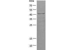 Western Blotting (WB) image for Dicer 1, Ribonuclease Type III (DICER1) (AA 1102-1314) protein (His-IF2DI Tag) (ABIN7122657) (DICER1 Protein (AA 1102-1314) (His-IF2DI Tag))