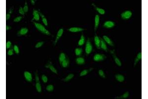 Immunofluorescence staining of Hela cells with ABIN7157190 at 1:100, counter-stained with DAPI. (Kallikrein 1 Antikörper  (AA 25-262))