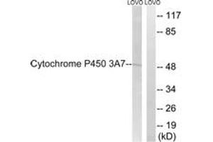 Western blot analysis of extracts from LOVO cells, using Cytochrome P450 3A7 Antibody. (CYP3A7 Antikörper  (AA 231-280))