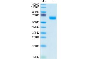 APCDD1 Protein (AA 27-492) (APC,His tag)