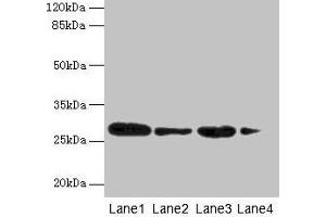 Western blot All lanes: MED7 antibody at 6 μg/mL Lane 1: Jurkat whole cell lysate Lane 2: Hela whole cell lysate Lane 3: Mouse thymus tissue Lane 4: NIH/3T3 whole cell lysate Secondary Goat polyclonal to rabbit IgG at 1/10000 dilution Predicted band size: 28 kDa Observed band size: 28 kDa (MED7 Antikörper  (AA 1-233))