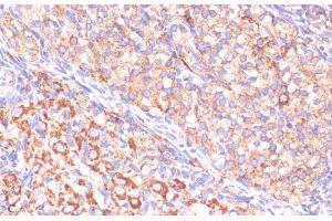 Immunohistochemistry of paraffin-embedded Rat ovary using VHL Polyclonal Antibody at dilution of 1:200 (40x lens). (VHL Antikörper)