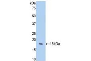 Detection of Recombinant FBN1, Rat using Polyclonal Antibody to Fibrillin 1 (FBN1) (Fibrillin 1 Antikörper  (AA 751-895))