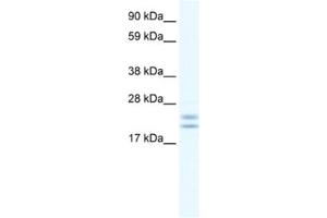 Western Blotting (WB) image for anti-Tubulin Polymerization Promoting Protein (Tppp) antibody (ABIN2461556) (Tppp Antikörper)