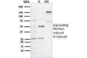 SDS-PAGE Analysis Purified Spastin Mouse Monoclonal Antibody (Sp 6C6). (Spastin Antikörper)