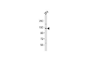 Anti-stk10 Antibody (Center)at 1:2000 dilution + ZF4 whole cell lysates Lysates/proteins at 20 μg per lane. (STK10-A Antikörper  (AA 342-376))