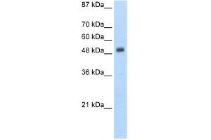 WB Suggested Anti-DES Antibody Titration:  5.