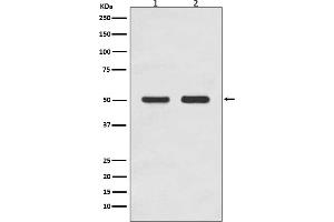 Western blot analysis of AP2M1 expression in (1) HEK293 cell lysate, (2) MCF-7 cell lysate.
