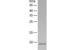 HBEGF Protein (AA 63-148) (His tag)