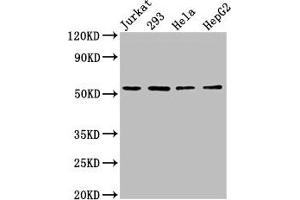 Western Blot Positive WB detected in: Jurkat whole cell lysate, 293 whole cell lysate, Hela whole cell lysate, HepG2 whole cell lysate All lanes: SLC16A12 antibody at 3 μg/mL Secondary Goat polyclonal to rabbit IgG at 1/50000 dilution Predicted band size: 54 kDa Observed band size: 54 kDa (SLC16A12 Antikörper  (AA 431-486))