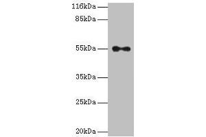 Western blot All lanes: THRA antibody at 2 μg/mL + A431 whole cell lysate Secondary Goat polyclonal to rabbit IgG at 1/10000 dilution Predicted band size: 55, 47, 51 kDa Observed band size: 55 kDa (THRA Antikörper  (AA 1-490))